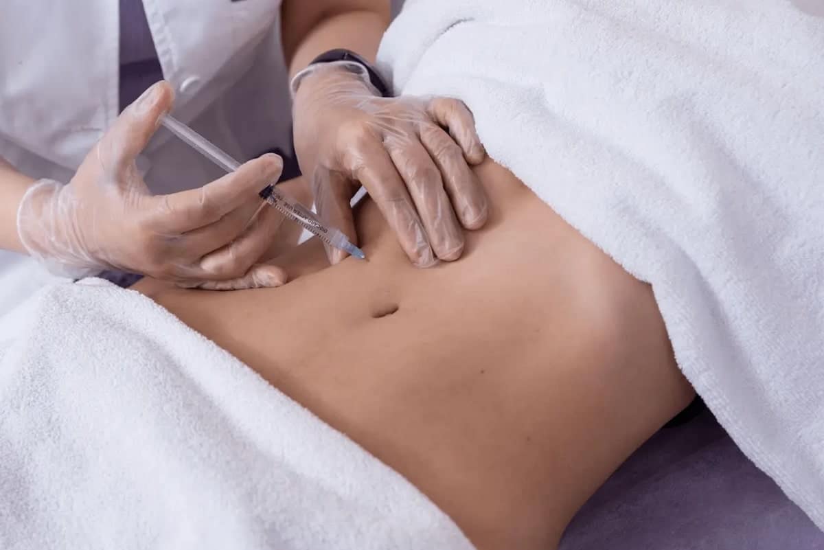 mesoterapia